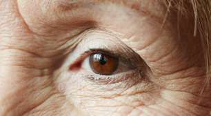 Lasers e cirurgias ampliam opções contra o glaucoma