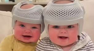 Fortuna! Saiba o valor e o motivo dos capacetes que gêmeos usam 23 horas por dia