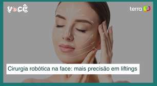 Cirurgia plástica robótica na face: mais precisão em resultados de liftings