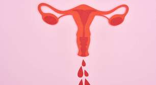 Menstruação abundante: entenda os sinais de alerta para sua saúde