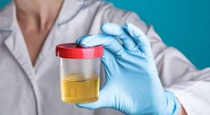 Teste rápido de urina identifica melhor tratamento para infecções