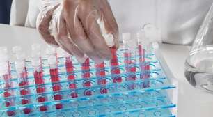 Escovas técnicas mantêm higienização eficiente de vidrarias em laboratórios