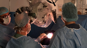 MAV: neurocirurgião explica como diagnosticar e tratar a condição