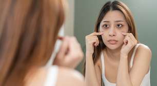 A ressaca após as festas afetou a pele? Especialista diz o que fazer