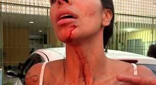 Mulher denuncia atacante do Vila Nova por agressão; confira