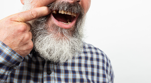 Perda de dentes em idosos piora a saúde e aumenta risco de morte; veja como prevenir