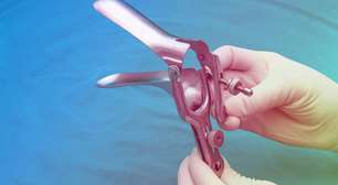 Saiba o que é o exame de papanicolau e qual a sua importância