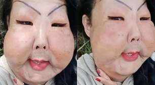 Uma nova mulher! Juju do Pix exibe evolução facial após cirurgia para remoção de óleo industrial; veja