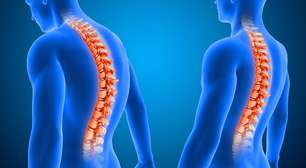 Cirurgia de escoliose é a 1ª com neuronavegação em Uberlândia