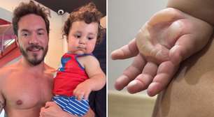 Eliezer atualiza recuperação do filho após cirurgia de emergência: 'Guerreiro'