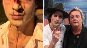 Fiuk aparece com o rosto esfolado após expor o pai: 'Que mundo é esse'