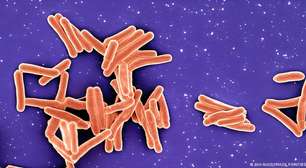 Brasil não atinge meta da OMS para reduzir casos de tuberculose