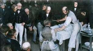 O pioneiro da cirurgia moderna hoje seria considerado um perigo: Robert Liston, "a faca mais rápida de Londres"