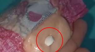 Criança é hospitalizada após consumir bala com comprimido dada por motorista de Fiat Uno