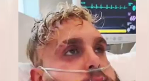 Jake Paul publica vídeo com a mandíbula fraturada após luta com Anthony Joshua