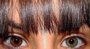 Um olho de cada cor: veja os famosos com heterocromia