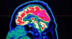 O mundo está ficando mais quente e isso está afetando nossos cérebros