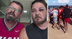 GRAVE! Casal é espancado por barraqueiros em praia de Porto de Galinhas