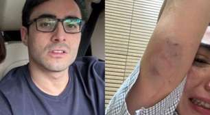 Representante do banco BTG agride companheira durante Réveillon em BH