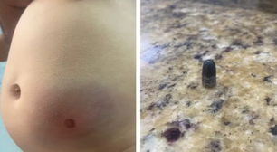 Bebê é atingida por bala perdida dentro de casa na noite de Ano Novo