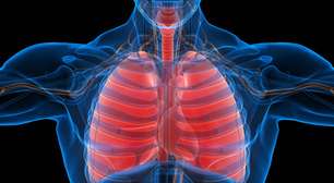 Tudo sobre a sarcoidose: causas, sintomas e casos famosos