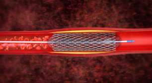 Cirurgia no coração: como o pentacampeão Roberto Carlos descobriu o problema