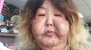 Juju do Pix mostra recuperação após cirurgia no rosto e rebate críticas: 'Um corpo é um corpo'