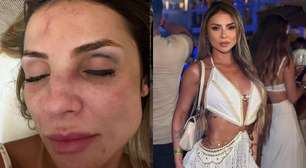 Influenciadora coloca câmeras em casa e registra agressão do ex-companheiro