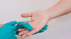 Hiperhidrose: o suor excessivo nas mãos