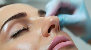 Desvio de septo: quando é hora de encarar a cirurgia para respirar melhor?