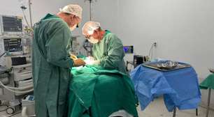 TRISTE! Caso raro de gêmeos siameses termina com morte do segundo bebê