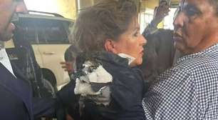 Susto! Deputada é atingida por explosivo na cabeça em entrevista