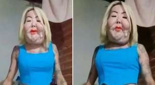 Juju do Pix mostra resultado de cirurgia para tirar óleo mineral do rosto após 50 dias