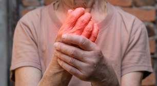 Doenças reumáticas: confira dicas importantes para lidar com elas no verão