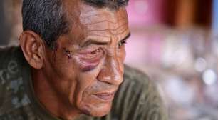 'Nunca pensei que fossem me atacar': os sobreviventes de ataque com míssil durante bombardeios dos EUA à Venezuela