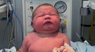 Bebê gigante de quase 13 libras surpreende médicos
