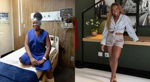 Ex-BBB Leidy Elin faz lipo; veja cuidados essenciais