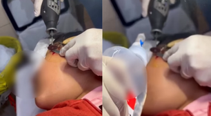 Criança de 10 anos fica com anzol preso na bochecha durante pescaria em GO; veja vídeo