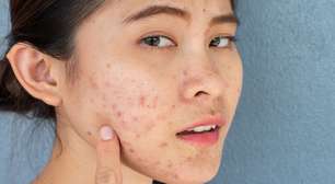 Descubra 4 maus hábitos do dia a dia que causam danos à pele