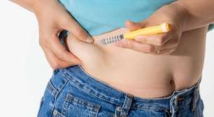Canetas emagrecedoras: o que saber antes da cirurgia plástica