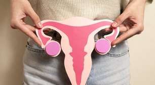 O que está por trás da Síndrome dos Ovários Policísticos?