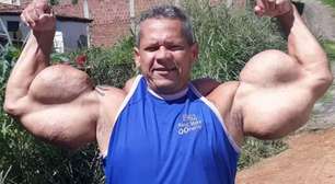 LUTO! Popeye Brasileiro morre precocemente aos 55 anos, em Olinda