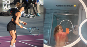 Tenista mexicana expõe queimaduras de sol após torneio na Austrália e alerta para riscos; veja como ficou