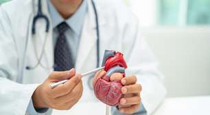 Tecnologia pode prevenir infartos com até 4 anos de antecedência