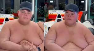 GordãoXJ choca ao revelar por quantas cirurgias precisará passar após perder 130 kg