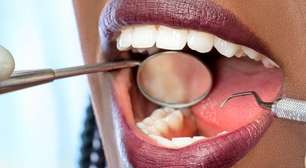 3 hábitos pra ter um sorriso saudável e evitar problemas bucais