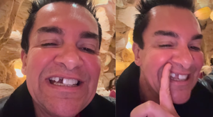 Regis Danese perde o dente e surpreende seguidores