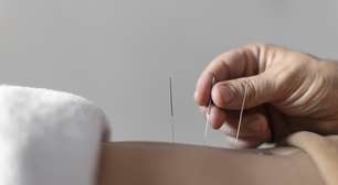 Os benefícios da acupuntura para a saúde mental