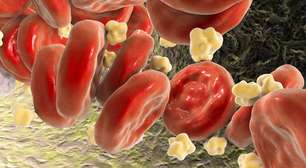 Estatinas: como funcionam, benefícios e cuidados necessários