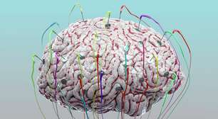 A tecnologia pode fazer cérebro funcionar melhor?